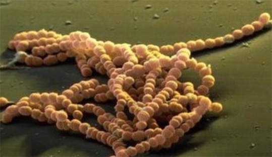世界上最神奇的细菌 以电子为食的食电细菌